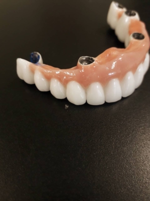 Имплантация