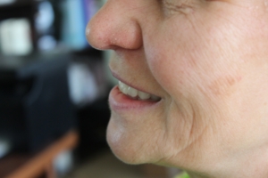 Съемное протезирование