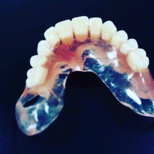 Съемные протезы