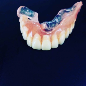 Съемные зубные протезы