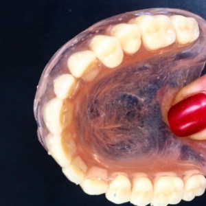 Заказать изготовление протеза