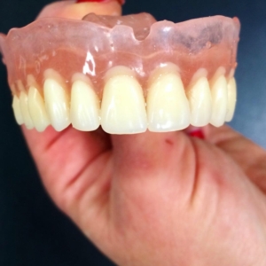 Съемные зубные протезы