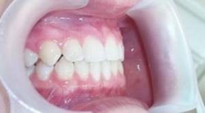 Стоимость ортодонтии