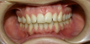 Ортодонтия