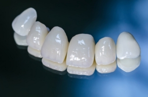 Несъемное зубное протезирование коронками